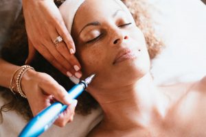 MicroNeedling